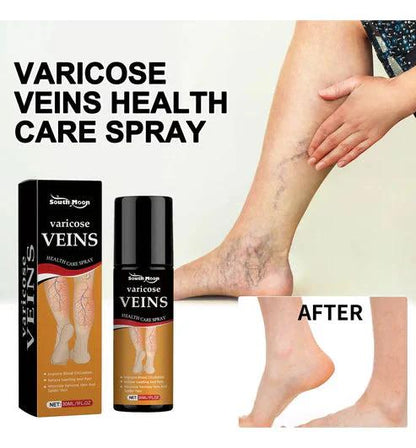 BEE VENOM VARICOSE VEINS RELIEF SPRAY (PACK OF 2) 🔥 BUY 1 GET 1 FREE 🔥
