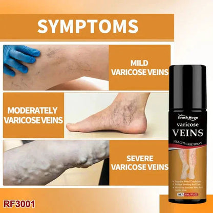 BEE VENOM VARICOSE VEINS RELIEF SPRAY (PACK OF 2) 🔥 BUY 1 GET 1 FREE 🔥