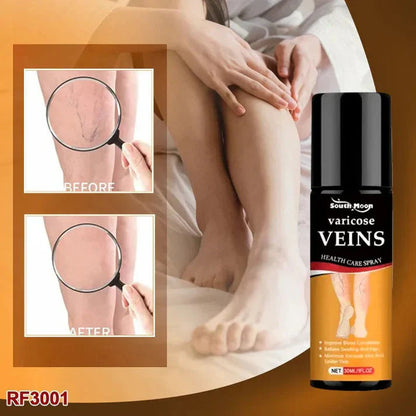 BEE VENOM VARICOSE VEINS RELIEF SPRAY (PACK OF 2) 🔥 BUY 1 GET 1 FREE 🔥