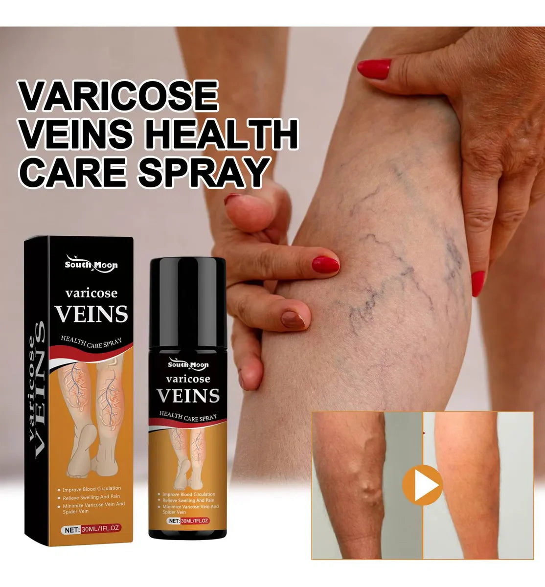 BEE VENOM VARICOSE VEINS RELIEF SPRAY (PACK OF 2) 🔥 BUY 1 GET 1 FREE 🔥