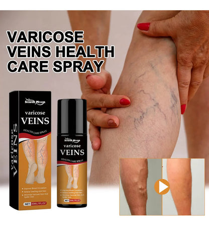 BEE VENOM VARICOSE VEINS RELIEF SPRAY (PACK OF 2) 🔥 BUY 1 GET 1 FREE 🔥